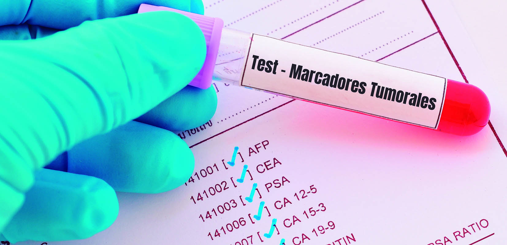 Test de marcadores tumorales
